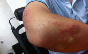 szpital ortopedyczny warszawa